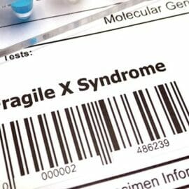 Bar code with the label "Fragile X Syndrome" above it, and a hand in a nitrile glove holding a glass beaker.